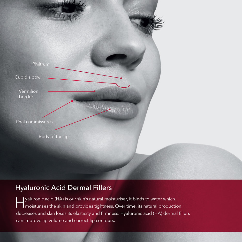 Belotero Shape & Contour Lips Patient Brochure