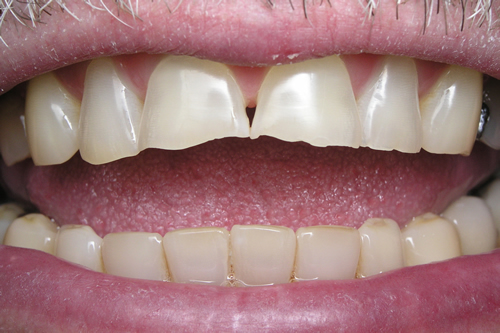 Smile Gallery Case Study Before Treatment